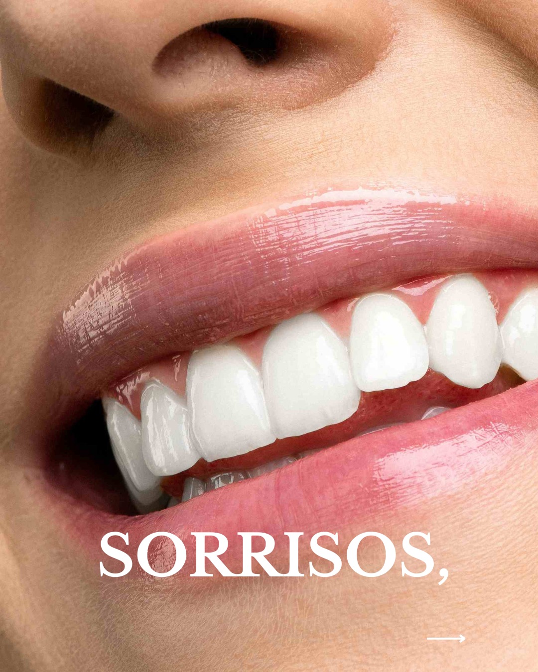 Detalhe de sorriso e saúde oral na Bmedical
